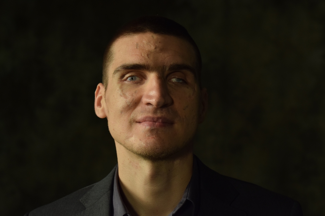 Hero-He lost his sight in the Ukrainian army. Now he helps make TD Trading Platforms more accessible.