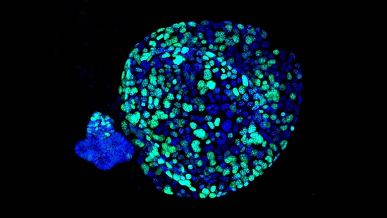Organoid - 3D cell models grown in a dish to replicate human organs